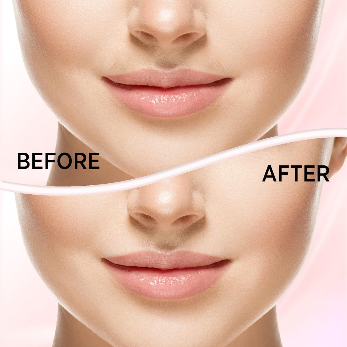 Facial Hair Removal for Women K49557